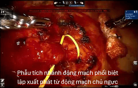 hinh-phau-thuat-1.png