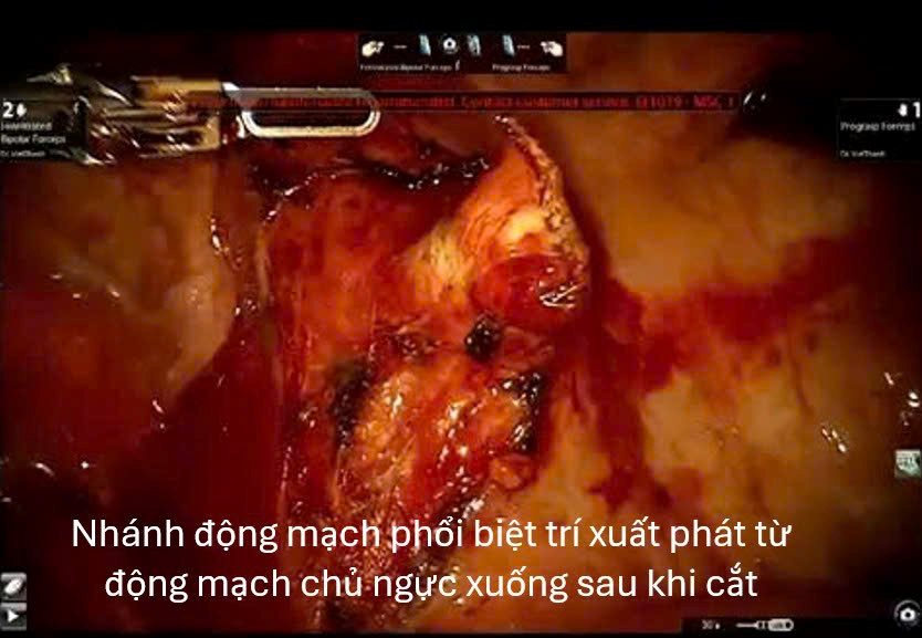 hinh-phau-thuat-2.png