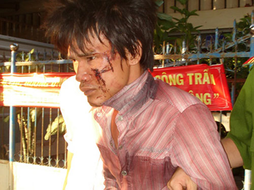 Khi thuốc trở thành “sát thủ”