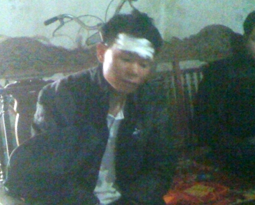Anh Nguyễn Thanh Sơn bị đ&aacute;nh trong thương ở v&ugrave;ng đầu.