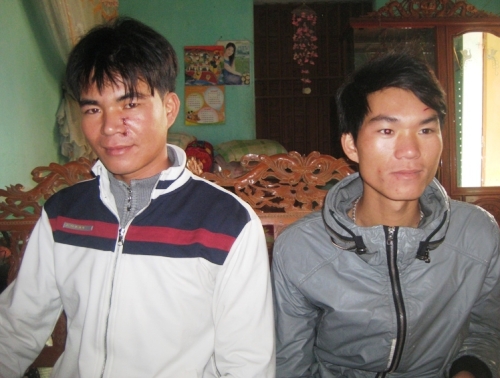 Chủ t&agrave;u Trương Đ&igrave;nh H&ugrave;ng (b&igrave;a tr&aacute;i) v&agrave; anh Trương Đ&igrave;nh Hải bị thương ở mặt do t&agrave;u lạ tấn c&ocirc;ng.