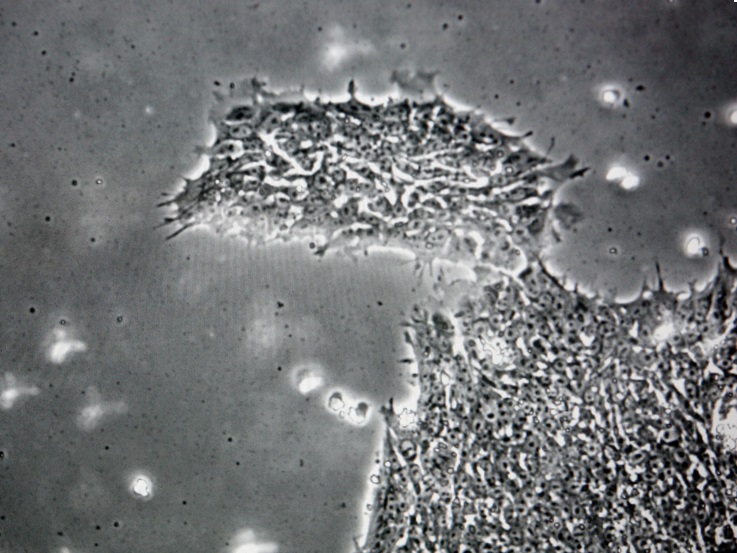Một loại virus c&oacute; thể ảnh hưởng khả năng nhận thức của con người