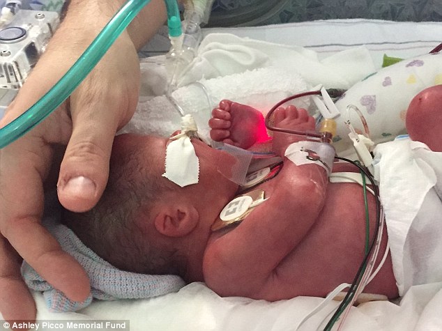 Hours after Chris tenderly serenaded his baby son at his bedside, Lennon died, aged just four days
