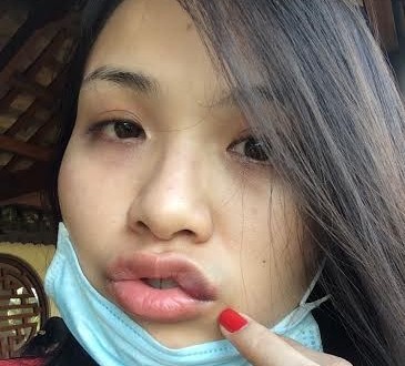 Diễm Hương lo sợ sau khi tố cáo "bị chồng hành hung"
