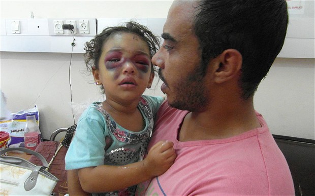 Trúng tên lửa Israel, bé gái Palestine bị ném lên không trung