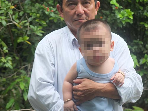 Vừa ra đời đã bị... chấn thương sọ não!