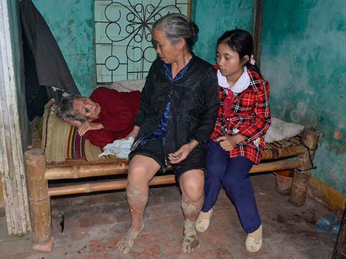 Tôi chỉ lo mình gục ngã...