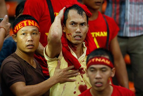 Một nam CĐV Việt Nam đổ m&aacute;u tr&ecirc;n kh&aacute;n đ&agrave;i s&acirc;n Shah Alam Ảnh: REUTERS