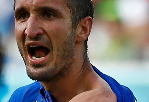 Pha “cẩu xực” của Suarez, từ trên xuống: Cắn vai Chiellini, nạn nhân và thủ phạm đều đau đớn, trung vệ Ý phô bày bằng chứng nhưng trọng tài trong trận đã bỏ qua Ảnh: REUTERS, DAILY MAIL