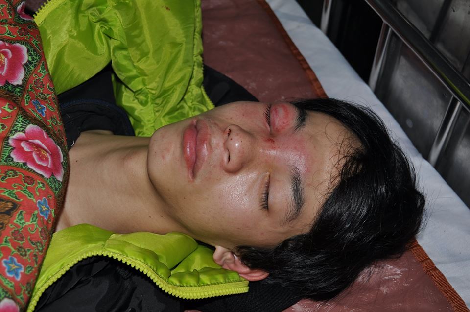 Nguyễn Năng Đ&ocirc;ng điều trị tại bệnh viện