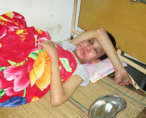 Truy tìm kẻ đánh bé trai khuyết tật dã man