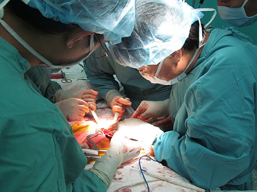 Một ca ghép thận tại Bệnh viện Nhân dân 115 (TP HCM) Ảnh: Nguyễn Thạnh