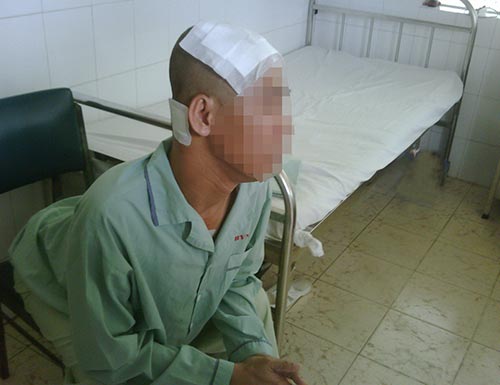 Trẻ cũng mắc bệnh Parkinson