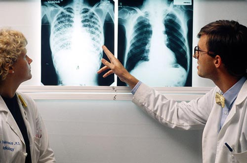 Cần phát hiện sớm những dấu hiệu của bệnh lao phổi để điều trị kịp thời Ảnh: DAILYMAIL