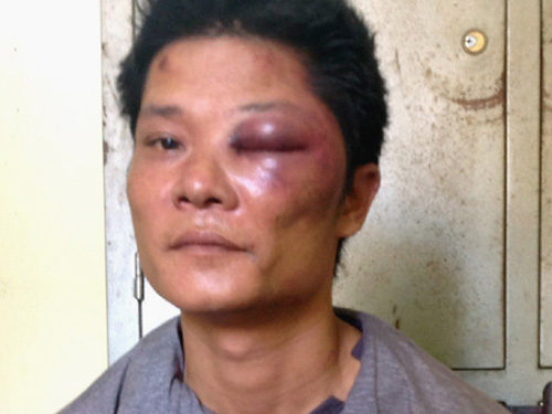 Khởi tố côn đồ đất mỏ xông vào trụ sở chém công an, cướp súng