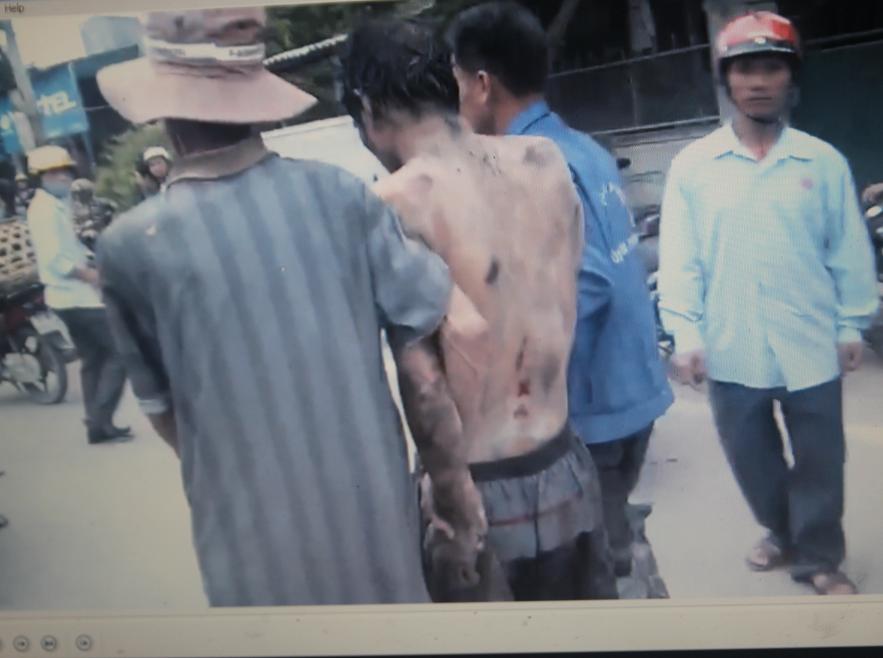 Người d&acirc;n đưa anh H. đi cấp cứu.