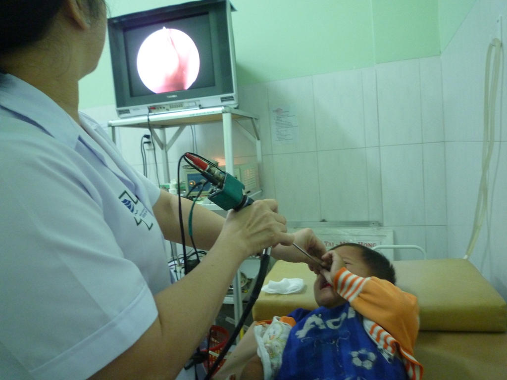 Đi tắm suối, bé 3 tuổi bị vắt chui vào mũi