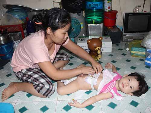 B&eacute; Đặng Bảo Ngọc đang mang bệnh hiểm ngh&egrave;o cần tiếp tục được phẫu thuật
