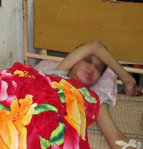 Sau hơn một tuần điều trị, sức khỏe của ch&aacute;u T&uacute; đ&atilde; bắt đầu hồi phục