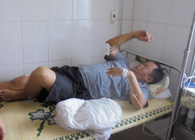 Vừa ra khỏi nhà, vô cớ bị chém nhập viện