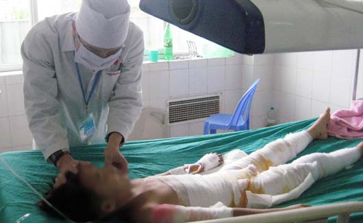 Vì con ăn gói mì tôm của bà, bố dùng rơm đốt con