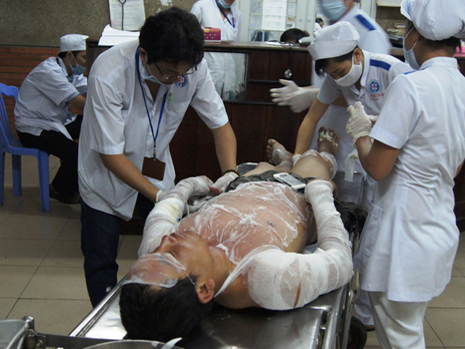 Dùng xăng tẩy nhựa đường, cả gia đình 3 người bỏng nặng