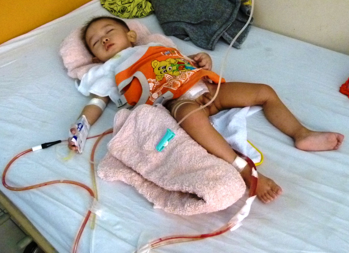 Chuyên gia Mỹ sẽ khám cho bé bị cắt nhầm bàng quang