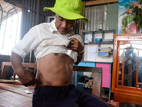 Bán thận để trả nợ