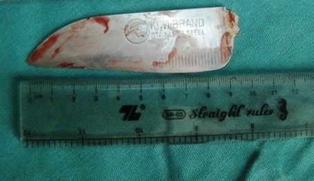2 phụ nữ ẩu đả, 1 bị cắt cổ chết, 1 trọng thương