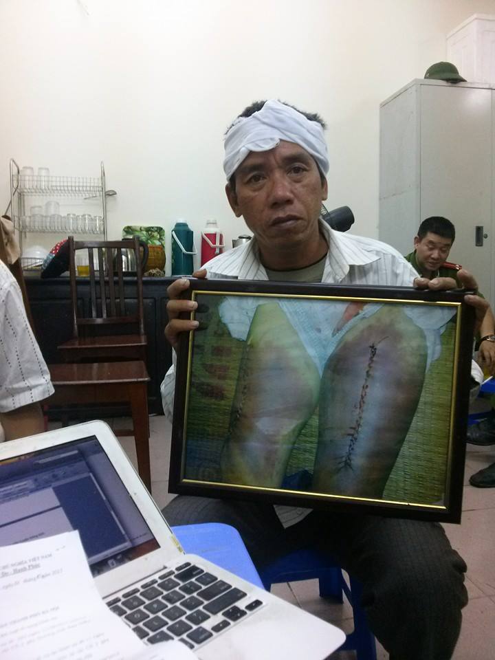 &Ocirc;ng Nguyễn Mậu Đo&agrave;n, em trai nạn nh&acirc;n