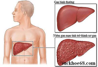 “Kẻ gặm nhấm” đáng sợ