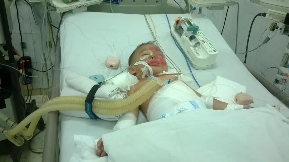 Đuối nước bị cho vào lu hơ, 2 trẻ thương vong