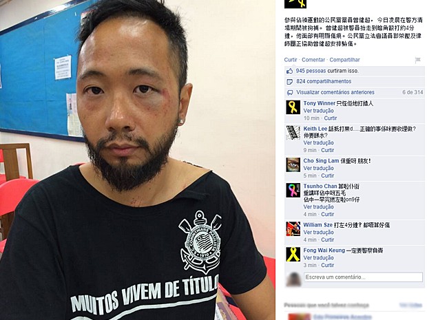 Postagem da p&aacute;gina do Partido C&iacute;vico no Facebook mostra Tsang ferido ap&oacute;s suposta agress&atilde;o de policiais em Hong Kong (Foto: Reprodu&ccedil;&atilde;o/Facebook)