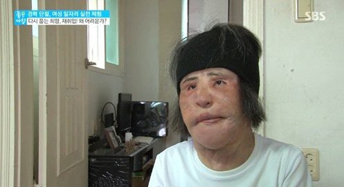 “Thảm họa dao kéo” xứ Hàn ngại ra đường