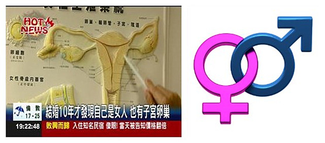 Khám dạ dày, người đàn ông phát hiện mình là nữ