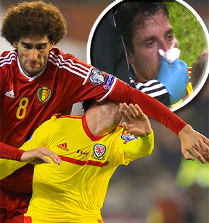 Fellaini giật chỏ sao Liverpool chảy máu mũi