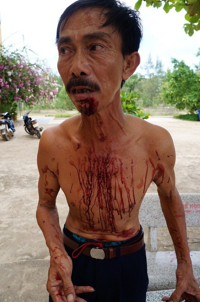 Đi nộp đơn xin học cho em, ra tay đánh bảo vệ rách cằm