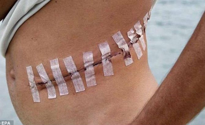 IS bán nội tạng con người để tài trợ cho các hoạt động khủng bố của chúng. Ảnh: EPA