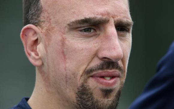 Ribery bất ngờ chia tay tuyển Pháp