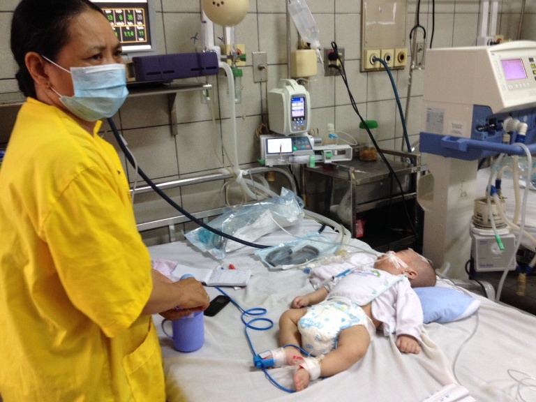 B&eacute; K.Đ.A (4 th&aacute;ng tuổi, ở Hưng Y&ecirc;n) nguy kịch v&igrave; biến chứng sởi đang được điều trị tại BV Bạch Mai (H&agrave; Nội)