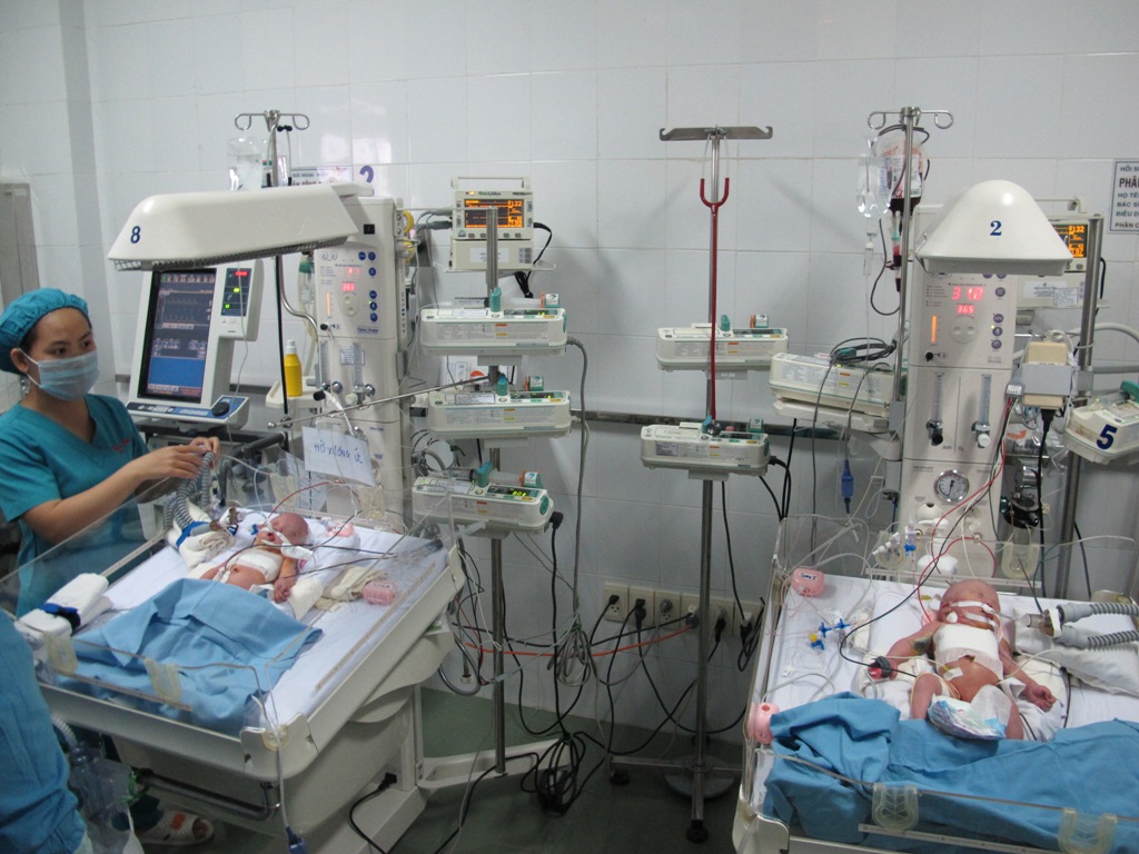 Một bé gái song sinh dính liền tiến triển tốt