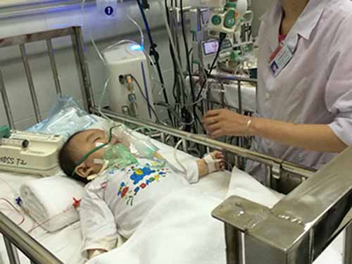 Cách phòng bệnh sởi cho trẻ