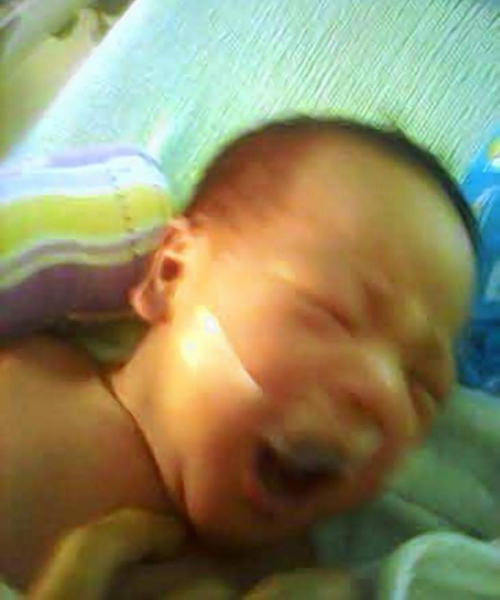 Y t&aacute; d&ugrave;ng băng keo d&aacute;n miệng đứa b&eacute;