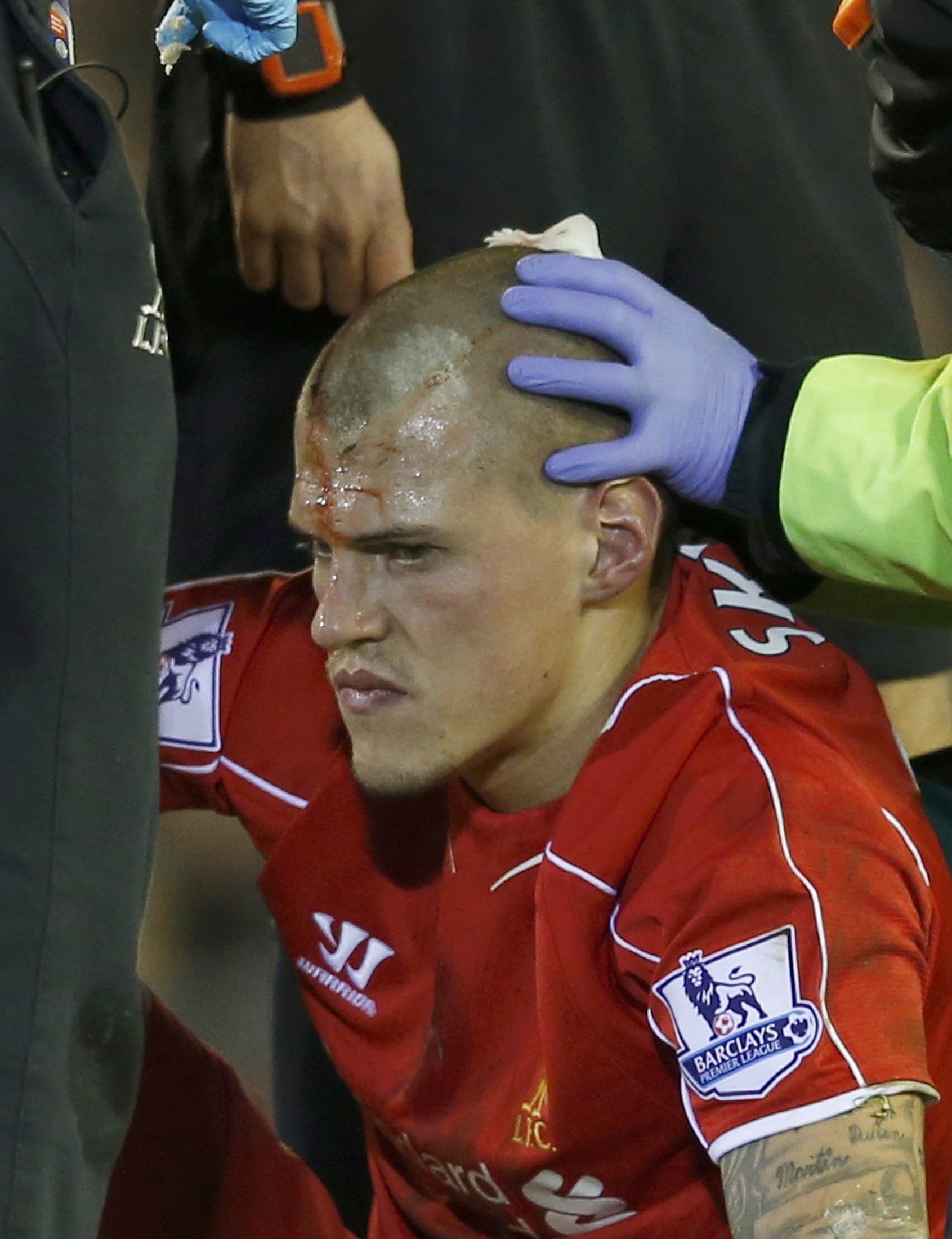 Chấn thương đầu không làm giảm đi sự hưng phấn của Skrtel