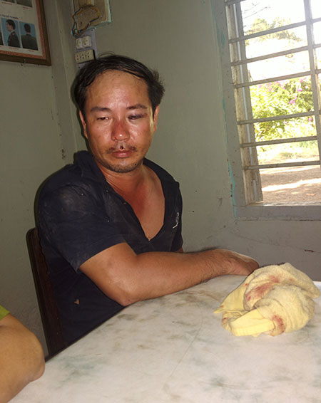 Truy sát, đâm bệnh nhân đến gãy cán dao trong bệnh viện