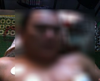 Cứu sống thanh niên bị đâm thủng tim