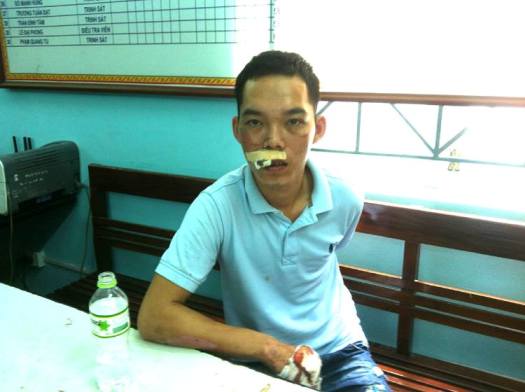 Mời bia xong, nhân viên quán nhậu đâm chết khách nhậu