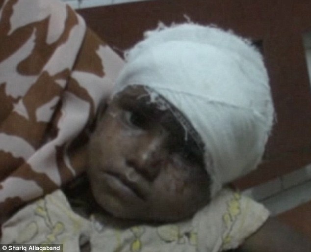 C&ocirc; b&eacute; Bharati Mondal trong bệnh viện. Ảnh: Daily Mail