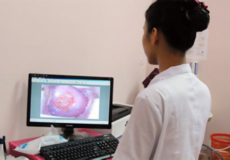 Lộ tuyến cổ tử cung có gây ung thư?