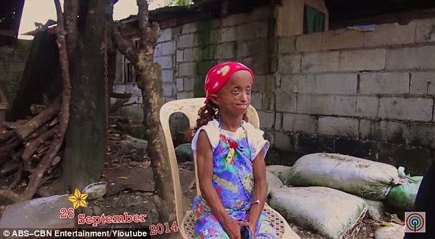 The young woman is often bullying because of her appearance and school was difficult